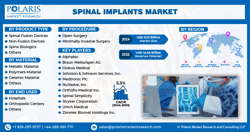 Spinal Implant